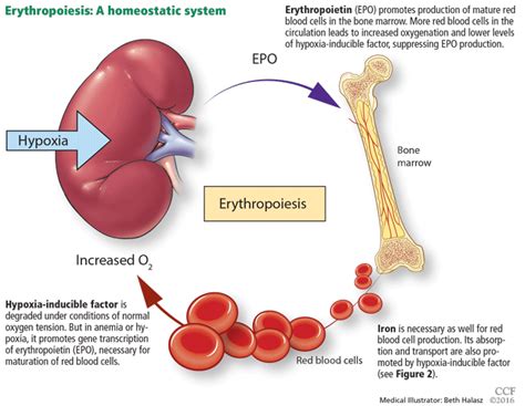 What Causes Anemia In Dialysis Patients